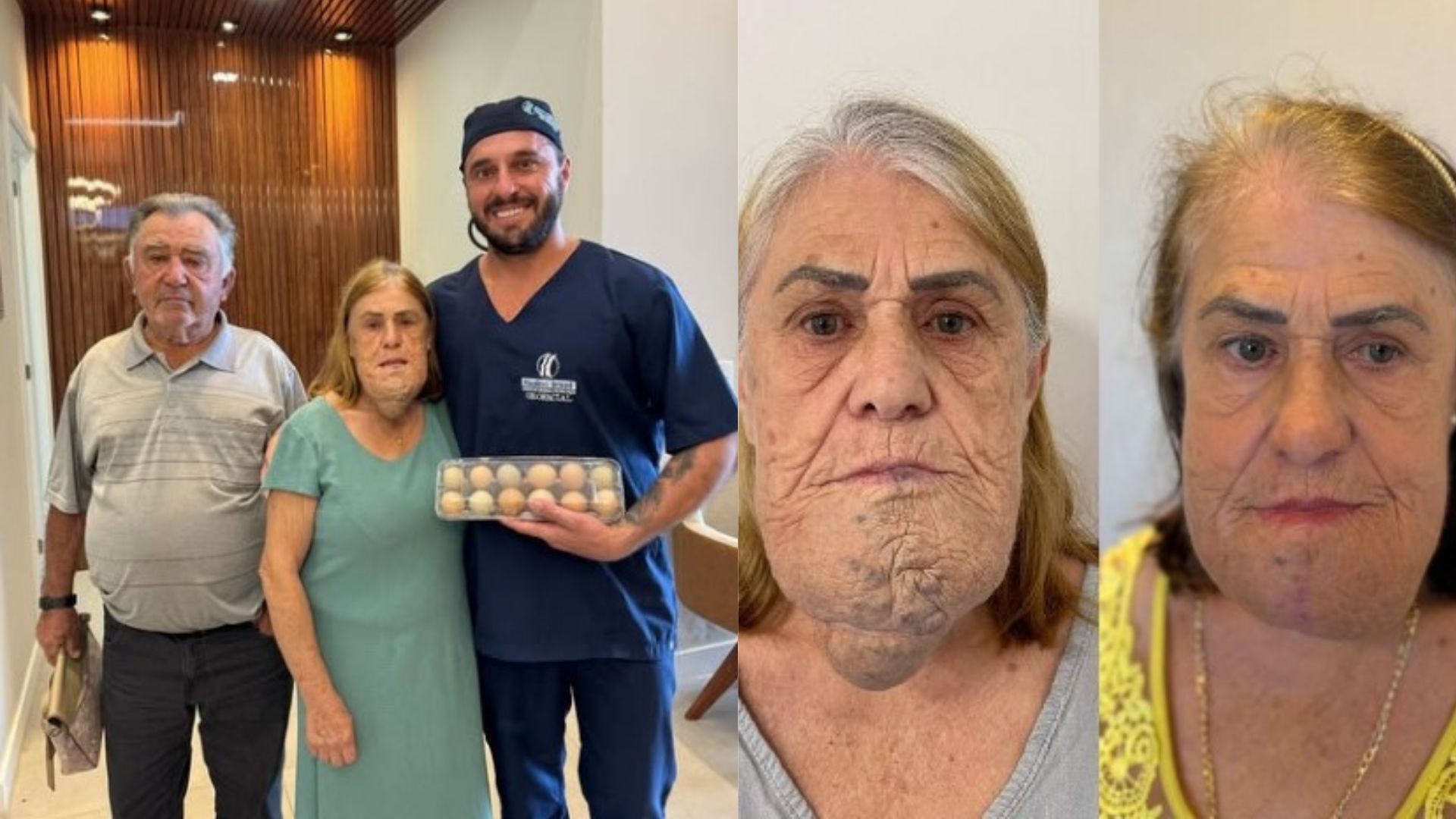 Mulher 'paga' cirurgia facial com ovos e galo em Santa Catarina