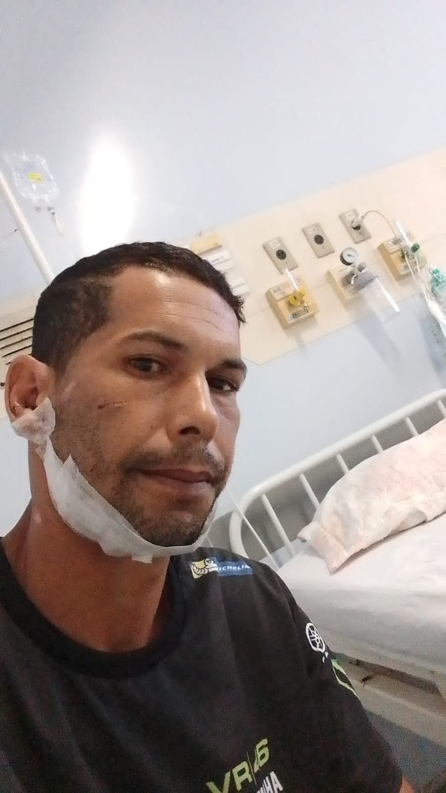 Pisoteado na cabeça por um touro de rodeio, Luís Carlos dos Santos passou por cirurgia na mandíbula